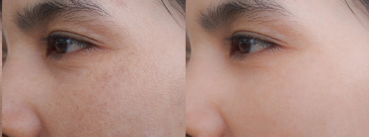 My 30-Day Journey Using Beef Tallow on My Skin