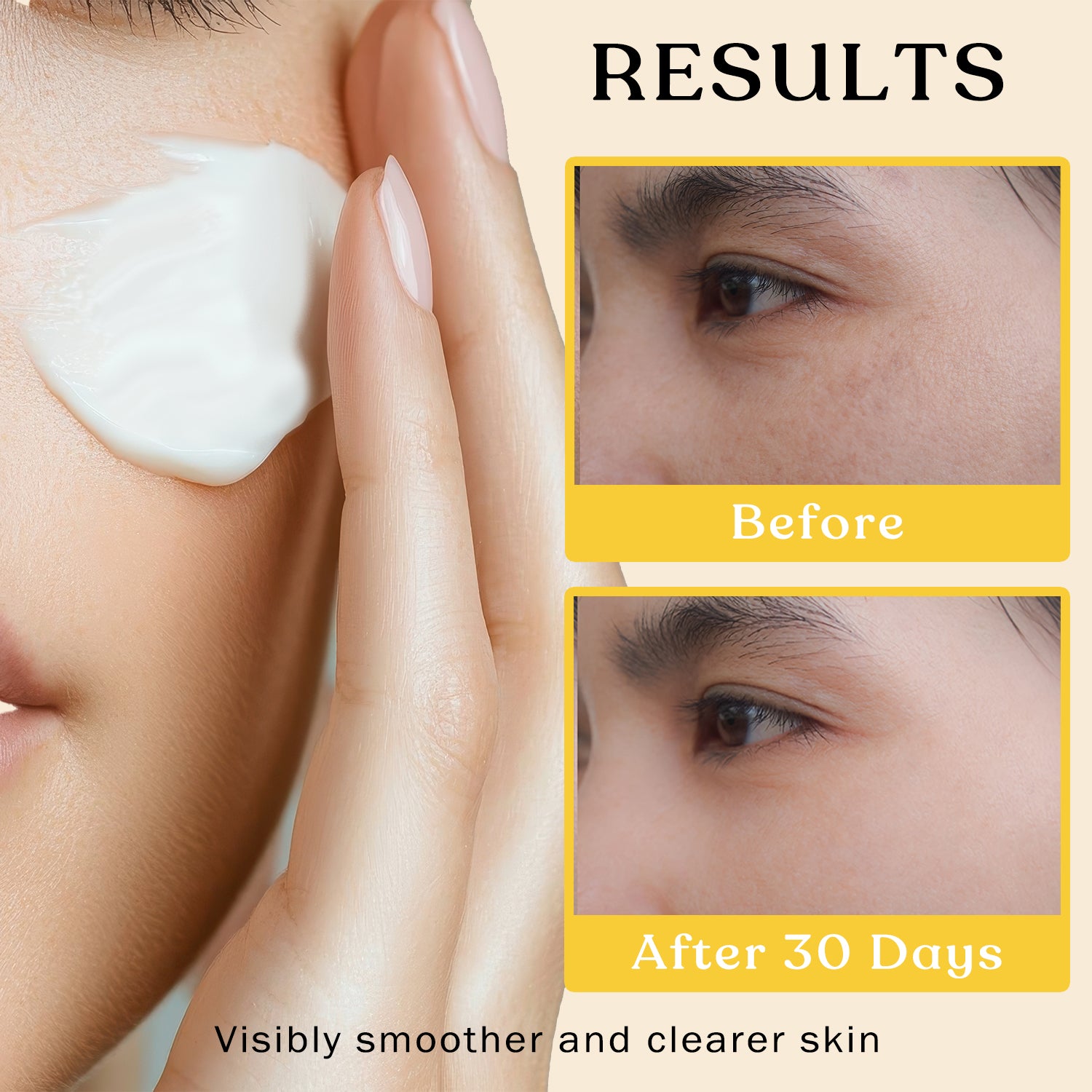 Brooksie Naturals Results Before After